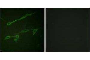 Immunofluorescence analysis of NIH-3T3 cells, using VAV2 (Phospho-Tyr142) Antibody. (VAV2 antibody  (pTyr142))