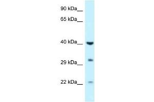 Western Blot showing GALK1 antibody used at a concentration of 1 ug/ml against Fetal Liver Lysate (GALK1 antibody  (C-Term))