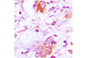 Immunohistochemistry (IHC) image for anti-Follistatin (FST) (Center) antibody (ABIN7297790)