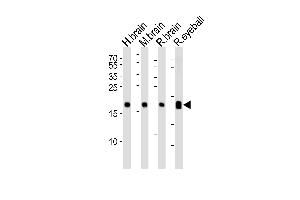 Western blot analysis of lysates from human brain, mouse brain, rat brain and rat eyeball tissue lysate (from left to right), using VILIP1 Antibody at 1:1000 at each lane.