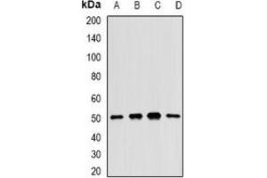 Western blot analysis of MKK5 expression in H460 (A), BT474 (B), mouse liver (C), rat kidney (D) whole cell lysates.