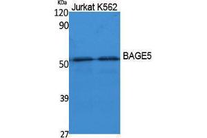 Western Blotting (WB) image for anti-B Melanoma Antigen Family, Member 5 (BAGE5) (N-Term) antibody (ABIN3178093) (BAGE5 antibody  (N-Term))