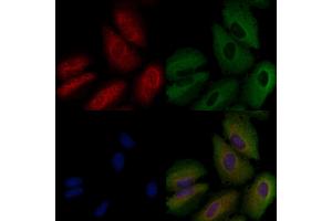 ABIN6258783 and ABIN6274160 staining  cells by IF/ICC. (Fgr antibody  (Internal Region))