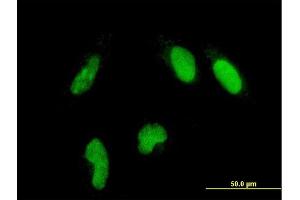 Immunofluorescence of monoclonal antibody to GLTSCR2 on HeLa cell. (GLTSCR2 antibody  (AA 402-478))