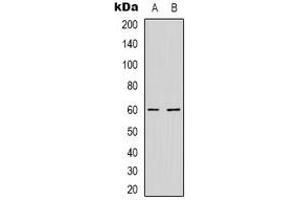 Western blot analysis of NXF3 expression in HepG2 (A), MCF7 (B) whole cell lysates. (NXF3 antibody)