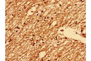 Immunohistochemistry analysis of human brain tissue using ABIN7173229 at dilution of 1:100 (Transmembrane Protein 47 (TMEM47) (AA 42-82) antibody)