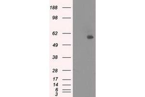 Image no. 1 for anti-Nuclear Receptor Binding Protein 1 (NRBP1) antibody (ABIN1499826)