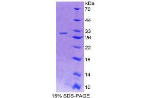 SDS-PAGE (SDS) image for Protein tyrosine Phosphatase, Receptor Type, H (PTPRH) (AA 685-909) protein (His tag) (ABIN2126546)