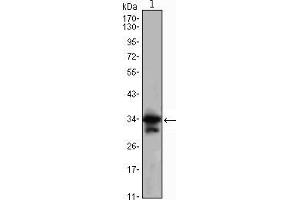 Western blot analysis using CDC2 mouse mAb against Jurkat (1) cell lysate. (CDK1 antibody)