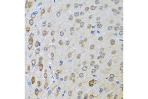 Immunohistochemistry of paraffin-embedded rat brain using BTD antibody (ABIN5973709) at dilution of 1/100 (40x lens). (BTD antibody)