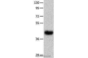 Western blot analysis of Human fetal muscle tissue  , using UTS2R Polyclonal Antibody at dilution of 1:400 (UTS2R antibody)
