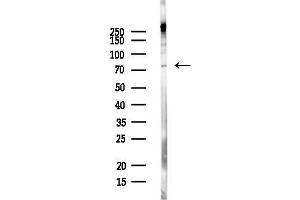 Western blot analysis of lysates from MCF7 cells(heat-shock,45 min treatment), using RAVER2 Antibody at 1/1000 dilution.