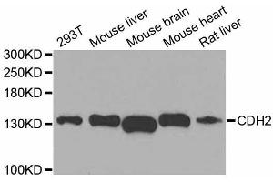 Western blot analysis of extracts of various cell lines, using CDH2 antibody. (N-Cadherin antibody  (AA 750-850))