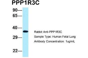 Host: Rabbit  Target Name: PPP1R3C  Sample Tissue: Human Fetal Lung  Antibody Dilution: 1. (PPP1R3C antibody  (N-Term))