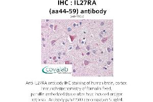 Image no. 1 for anti-Interleukin 27 Receptor, alpha (IL27RA) (AA 44-59) antibody (ABIN1735897) (IL27 Receptor alpha antibody  (AA 44-59))