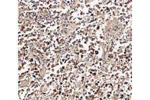 IHC analysis of MIF using anti-MIF antibody (ABIN3043878).