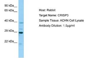 Western Blotting (WB) image for anti-Cysteine-Rich Secretory Protein 3 (CRISP3) (N-Term) antibody (ABIN2789796) (CRISP3 antibody  (N-Term))