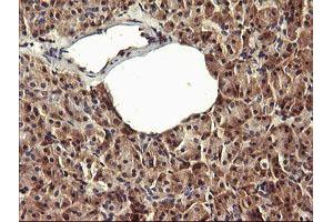 Image no. 3 for anti-Peptidyl Arginine Deiminase, Type IV (PADI4) (AA 299-588) antibody (ABIN1491356) (PAD4 antibody  (AA 299-588))