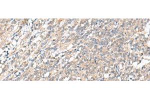 Immunohistochemistry of paraffin-embedded Human tonsil tissue using WDR47 Polyclonal Antibody at dilution of 1:35(x200) (WDR47 antibody)