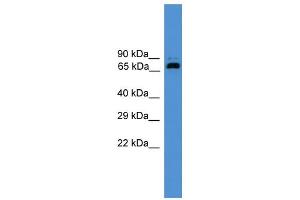 WB Suggested Anti-USP2 Antibody Titration: 0. (USP2 antibody  (Middle Region))