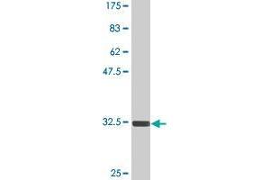 Western Blot detection against Immunogen (32. (TGIF2 antibody  (AA 114-175))