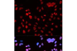 Immunofluorescence (IF) image for anti-Tumor Protein P53 (TP53) (pSer9) antibody (ABIN7265080)