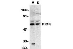 Western Blotting (WB) image for anti-Receptor-Interacting Serine-threonine Kinase 2 (RIPK2) (N-Term) antibody (ABIN1031540) (RIPK2 antibody  (N-Term))