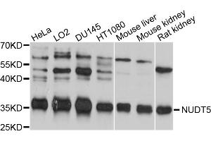 Western blot analysis of extracts of various cell lines, using NUDT5 antibody (ABIN5998398) at 1/1000 dilution.