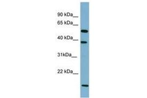 Image no. 1 for anti-Solute Carrier Family 10 (Sodium/bile Acid Cotransporter Family), Member 1 (SLC10A1) (AA 107-156) antibody (ABIN6741685)