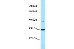 WB Suggested Anti-PROCA1 Antibody Titration: 1. (PROCA1 antibody  (C-Term))