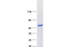 CHN1 Protein (Transcript Variant 2) (Myc-DYKDDDDK Tag)