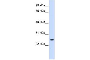 WB Suggested Anti-NOL3 Antibody Titration:  0. (NOL3 antibody  (Middle Region))