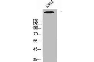 Western Blot analysis of K562 cells using Talin-1 Polyclonal Antibody (TLN1 antibody  (C-Term))