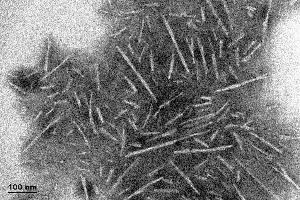 Electron Microscopy (EM) image for Synuclein, alpha (SNCA) (full length) (Active) protein (ABIN5065829)