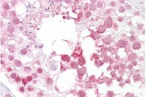 Immunohistochemistry with Testis tissue at an antibody concentration of 5µg/ml using anti-Ift88 antibody (ARP53657_P050) (IFT88 antibody  (N-Term))