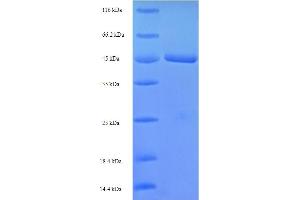 SDS-PAGE (SDS) image for NCAP (AA 188-739), (partial) protein (His-SUMO Tag) (ABIN5710804) (NCAP (AA 188-739), (partial) protein (His-SUMO Tag))