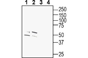 Western blot analysis of mouse brain lysates (lanes 1 and 3) and rat brain membranes (lanes 2 and 4): 1-2.