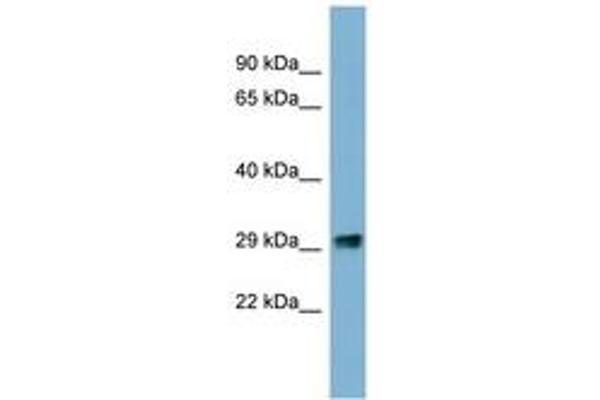 PRKRIP1 antibody  (N-Term)