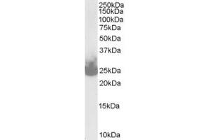 Western Blotting (WB) image for anti-Synaptosomal-Associated Protein, 25kDa (SNAP25) (C-Term) antibody (ABIN2465306) (SNAP25 antibody  (C-Term))