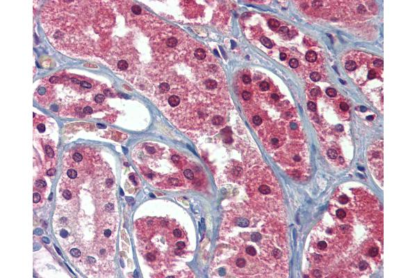 AAK1 antibody  (C-Term)