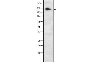 ALPK3 antibody  (C-Term)