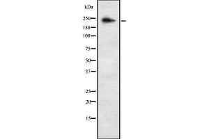 Western blot analysis of ALPK3 using K562 whole cell lysates