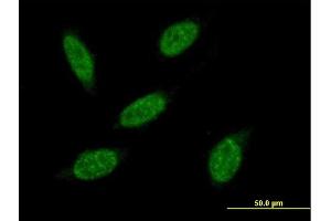 Immunofluorescence of purified MaxPab antibody to RNF20 on HeLa cell. (RNF20 antibody  (AA 1-975))
