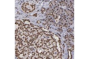 Immunohistochemical staining of human pancreas with CSDC2 polyclonal antibody  shows strong nuclear positivity in both exocrine glandular cells and Islet cells.