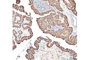 IHC analysis of PPA2 using anti-PPA2 antibody (ABIN6719431).