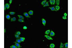 Immunofluorescent analysis of PC-3 cells using ABIN7144259 at dilution of 1:100 and Alexa Fluor 488-congugated AffiniPure Goat Anti-Rabbit IgG(H+L) (Annexin a1 antibody  (AA 138-222))