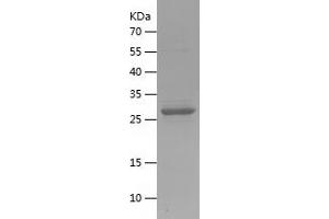 Western Blotting (WB) image for BAI1-Associated Protein 3 (BAIAP3) (AA 963-1187) protein (His tag) (ABIN7283454) (BAIAP3 Protein (AA 963-1187) (His tag))