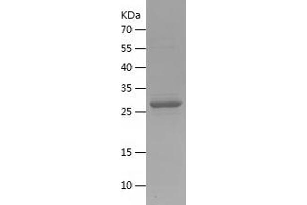 BAIAP3 Protein (AA 963-1187) (His tag)