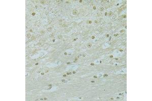 Immunohistochemistry (Paraffin-embedded Sections) (IHC (p)) image for anti-Regulator of Chromosome Condensation 1 (RCC1) (AA 1-240) antibody (ABIN6146817)