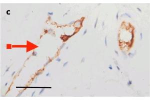 IHC Validation of Envelope in COVID-19 Patient Skin: (Magro et al. (SARS-CoV-2 Envelope antibody  (N-Term))
